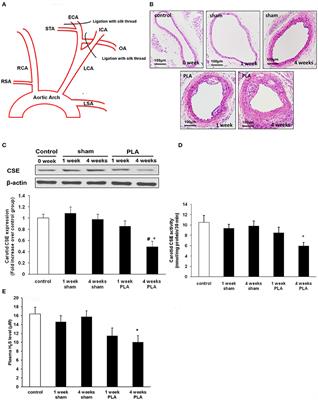 Hydrogen Sulfide Attenuates Atherosclerosis in a Partially Ligated Carotid Artery Mouse model via Regulating Angiotensin Converting Enzyme 2 Expression